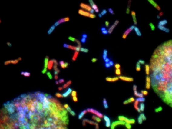 Stain image of chromosomes under a microscope